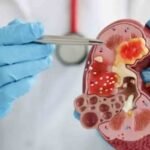 Rising Kidney Disease Deaths in Telangana