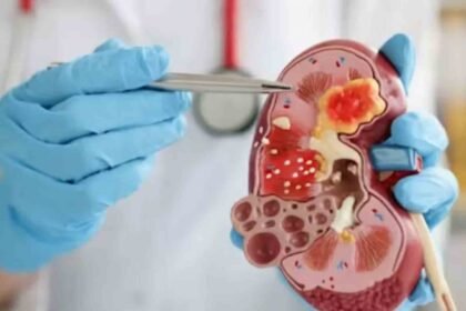 Rising Kidney Disease Deaths in Telangana